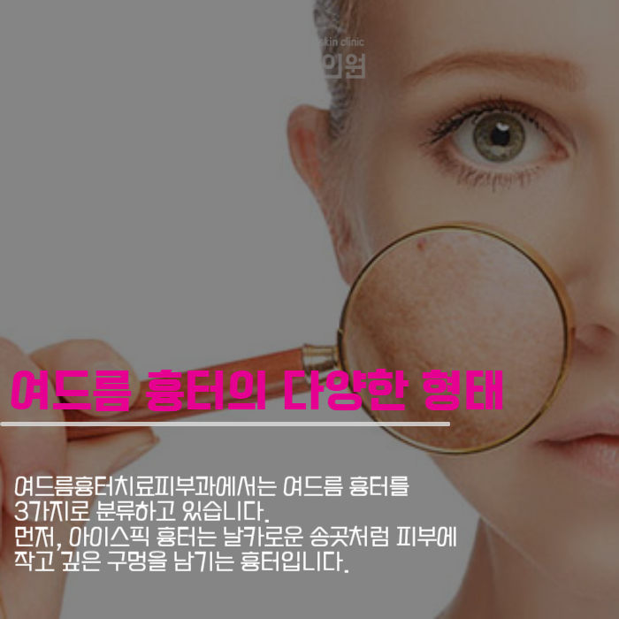 여드름흉터치료피부과 맞춤형 치료 서비스 관련 이미지 2