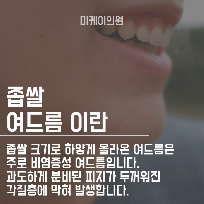 강남여드름피부과 깨끗한 피부를 갖고 싶다면 관련 이미지 2