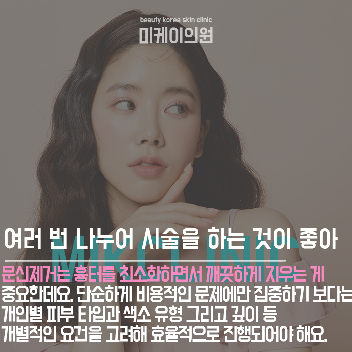 문신제거주의사항 흉터를 최소화하고 깨끗하게 지워요. 관련 이미지 2