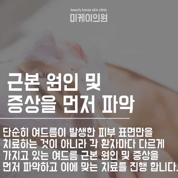 서초구피부관리 좁쌀여드름원인 및 관리법 초기부터 관련 이미지 6