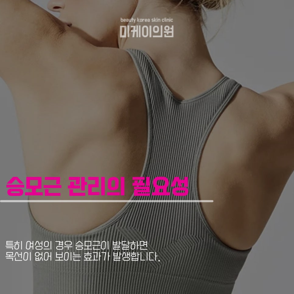 Learn About the Duration and Precautions of Trapezius Botox image 2