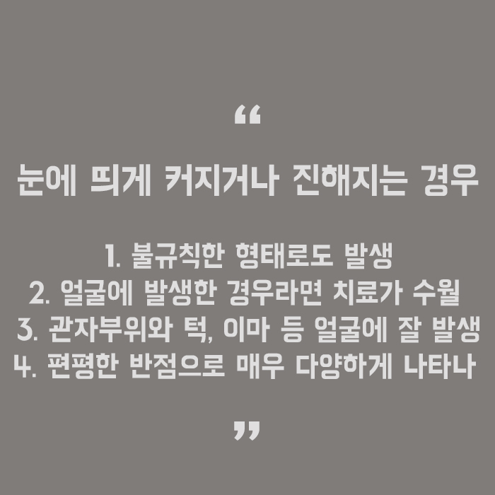 난치성갈색반점 어렵고 재발이 잦은 질환 관련 이미지 5