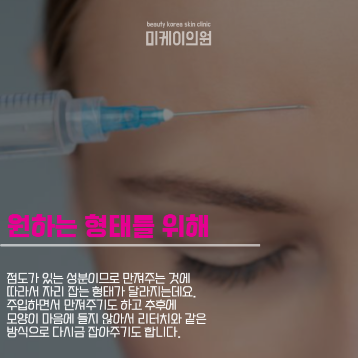 As Forehead Filler Molding Changes the Level of Finish image 2