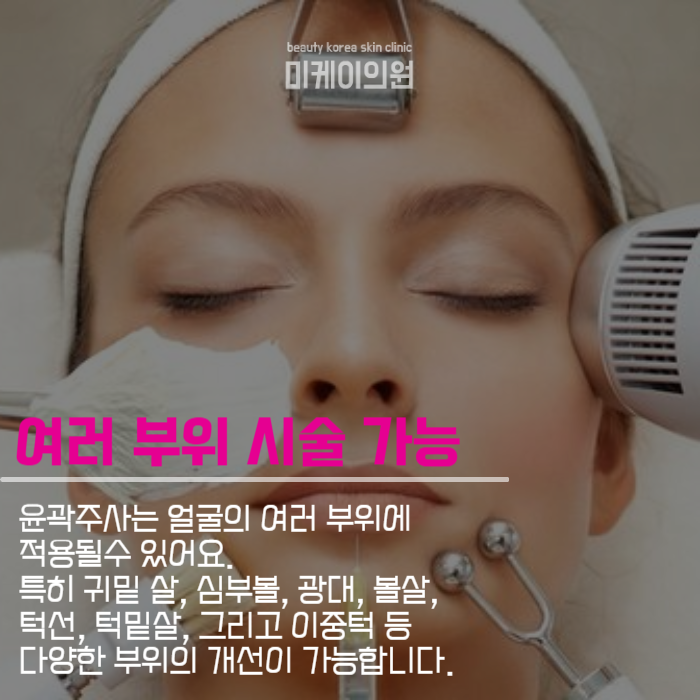 윤곽주사주의사항 알아보아요 관련 이미지 3