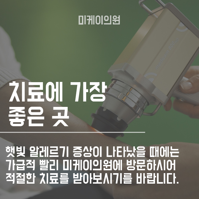 햇빛 알레르기 증상 왜 나타나는 것일까? 관련 이미지 6