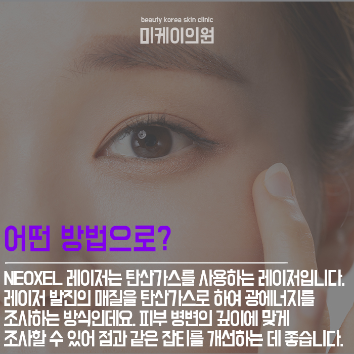 얼굴점제거팁 이것만큼은 꼭 기억하세요 관련 이미지 3