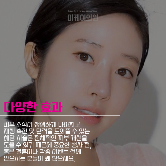 스킨부스터 주기 빠른 변화를 위한 선택 관련 이미지 5