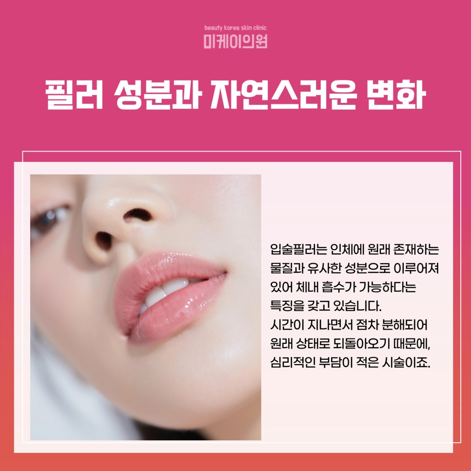서울 서초동 입술필러로 만나는 새로운 나 관련 이미지 4