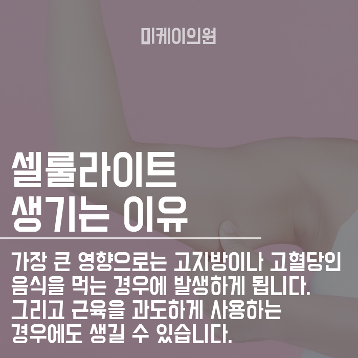 팔뚝 셀룰라이트 없애는 방법 관련 이미지 2