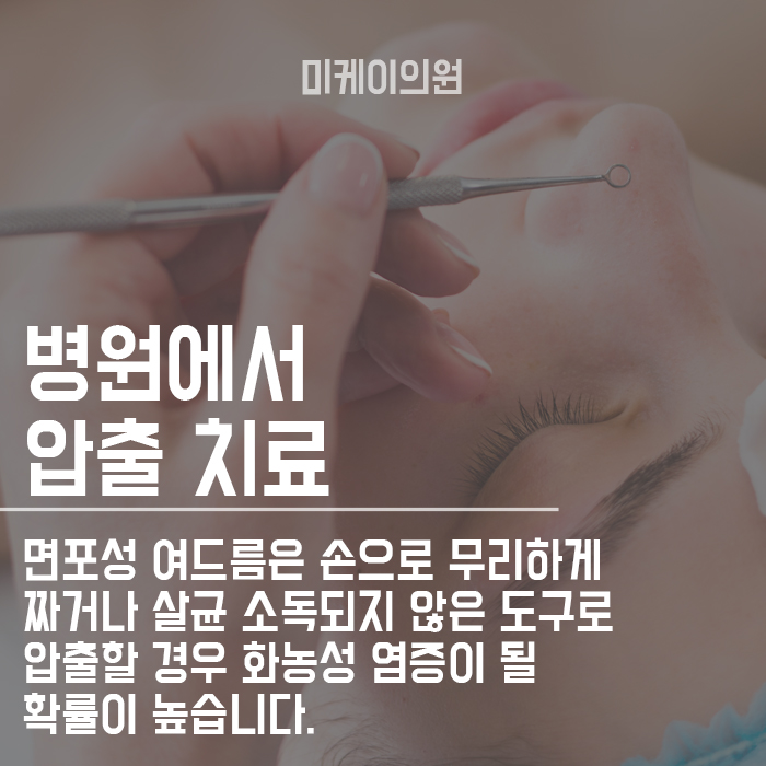 면포성여드름 초기관리 늦지 않게 관리해야 합니다. 관련 이미지 4