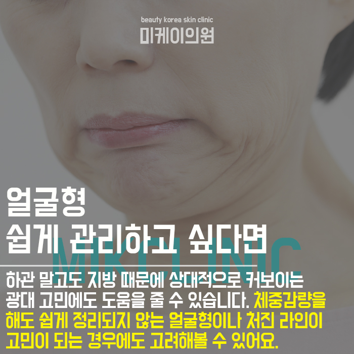 턱살보톡스효과 이중턱 없애고 또렷한 라인을 관련 이미지 3