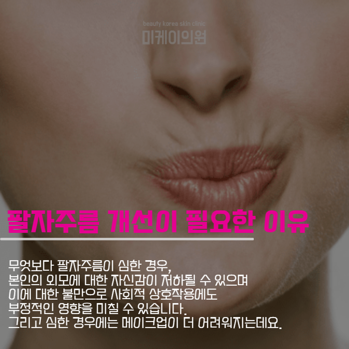 팔자주름실리프팅 날렵한 얼굴 라인 관련 이미지 2