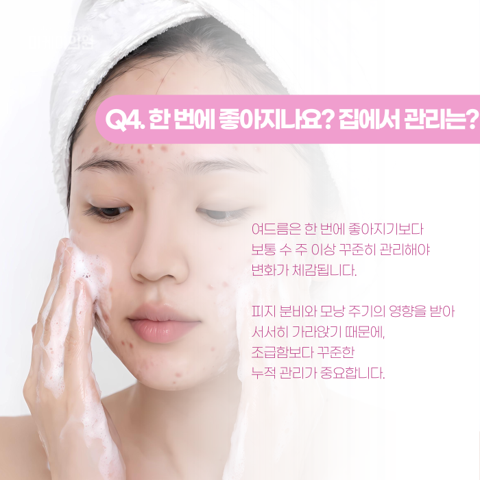 강남 여드름 피부과, 언제부터 가야 할까? 관련 이미지 5