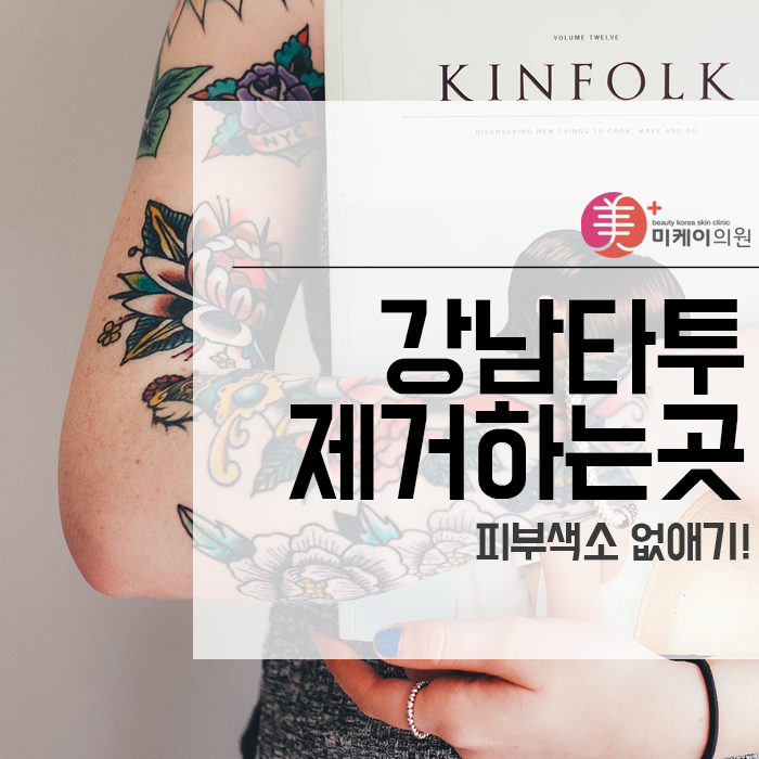 강남타투제거하는곳 피부색소 없애기! 관련 이미지 1