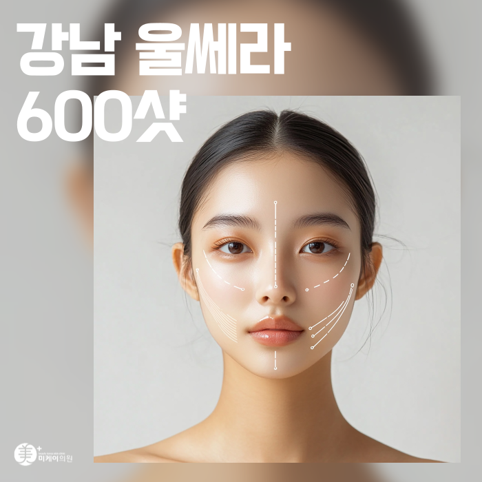 Gangnam Ulthera 600 Shots: Pain, Effects, and Duration image 1