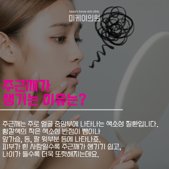 강남주근깨 얼룩덜룩해진 이유는 관련 이미지 3