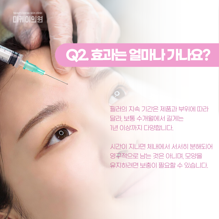 Dermal Fillers Near Gangnam Station: Where and How Should They Be Injected? image 3