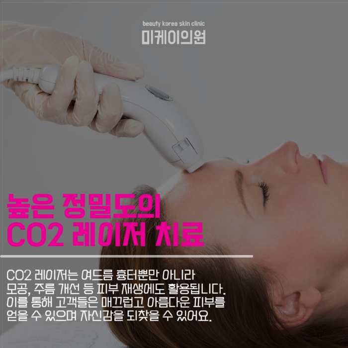 서초흉터병원 여드름 흉터 치료와 맞춤형 시술 관련 이미지 3