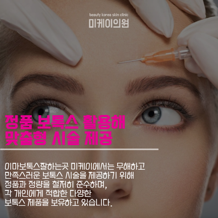 이마보톡스잘하는곳 이마 주름 지우기 관련 이미지 2
