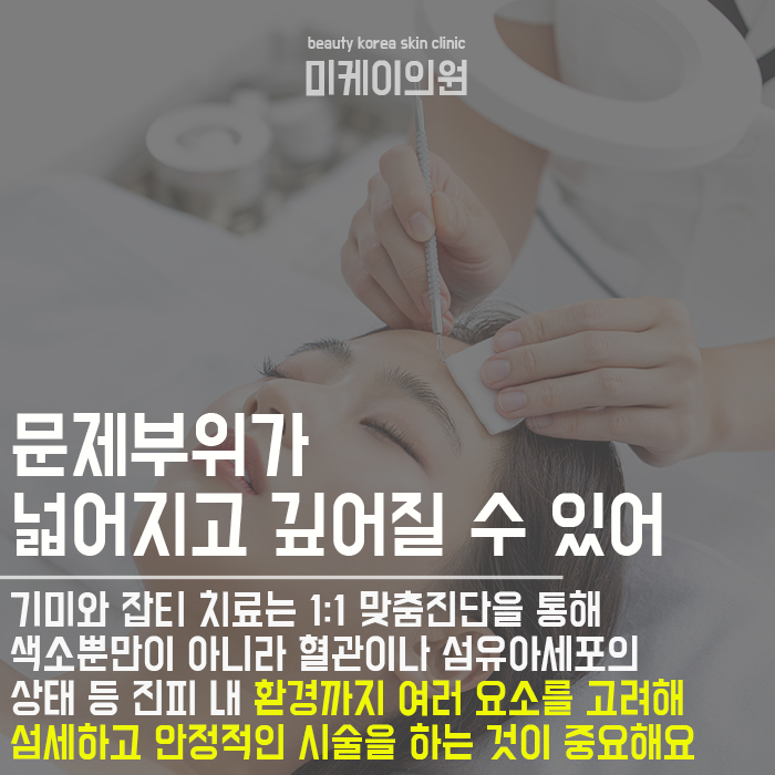 얼굴잡티제거시술 부담없이 시작해요 관련 이미지 3