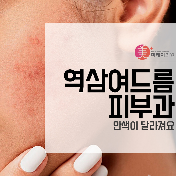 역삼여드름피부과 안색이 달라져요 관련 이미지 1