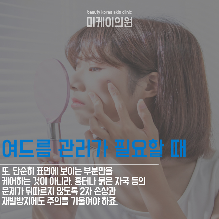 강남피부과추천 여러 가지 시술을 통해 관련 이미지 5