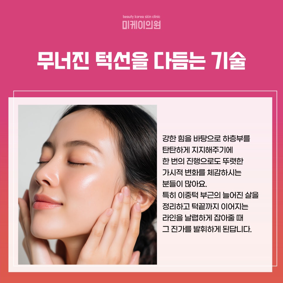 강남 민트실리프팅 영혼까지 끌어올린 관련 이미지 4