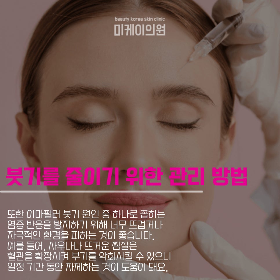 What Causes Swelling After Forehead Filler and How to Reduce It image 4