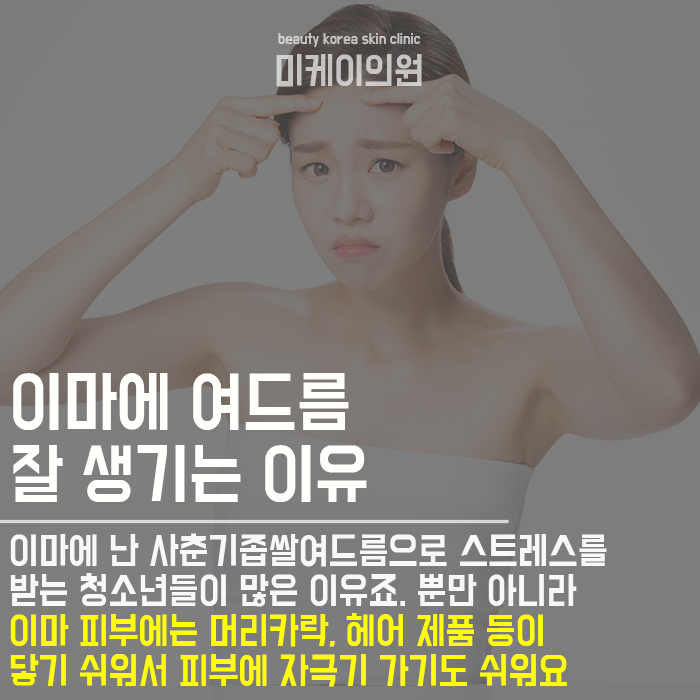 사춘기좁쌀여드름 원인 알고 없애요 관련 이미지 4