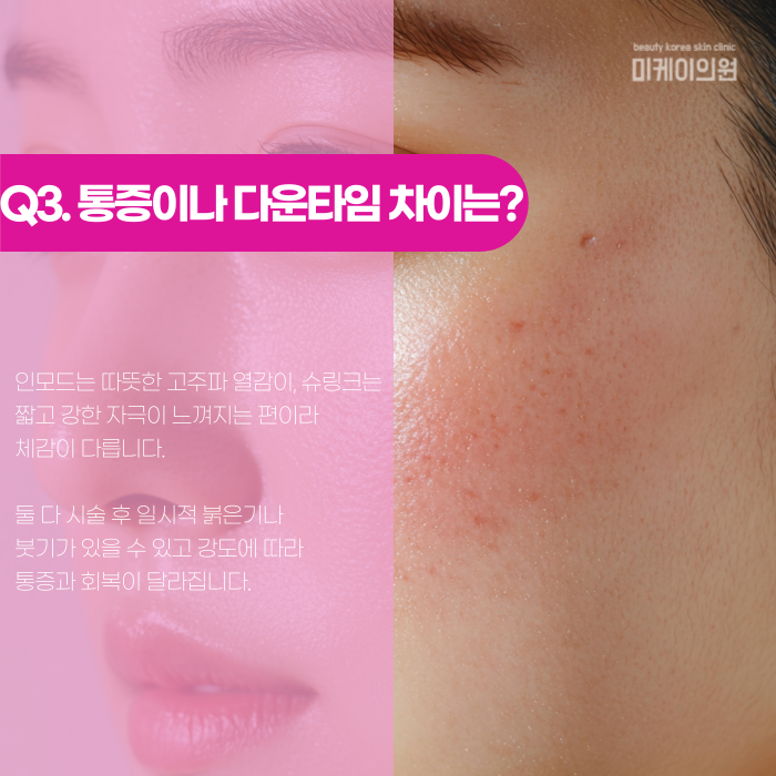 인모드 vs 슈링크, 나는 뭐가 맞을까? 관련 이미지 4