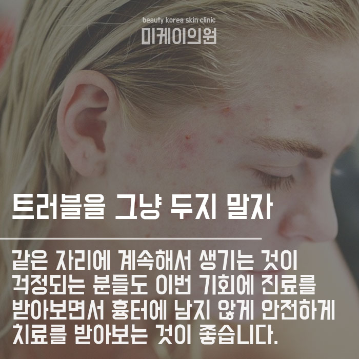 생리전 턱여드름 생기는 이유는 뭘까요 관련 이미지 6