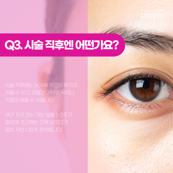 서초 아이라인 반영구, 번지지 않게 하려면? 관련 이미지 4
