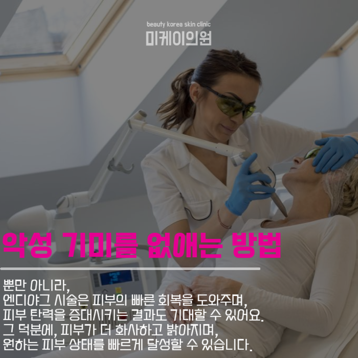 기미주근깨치료로 피부 건강과 자신감을 동시에 관련 이미지 4