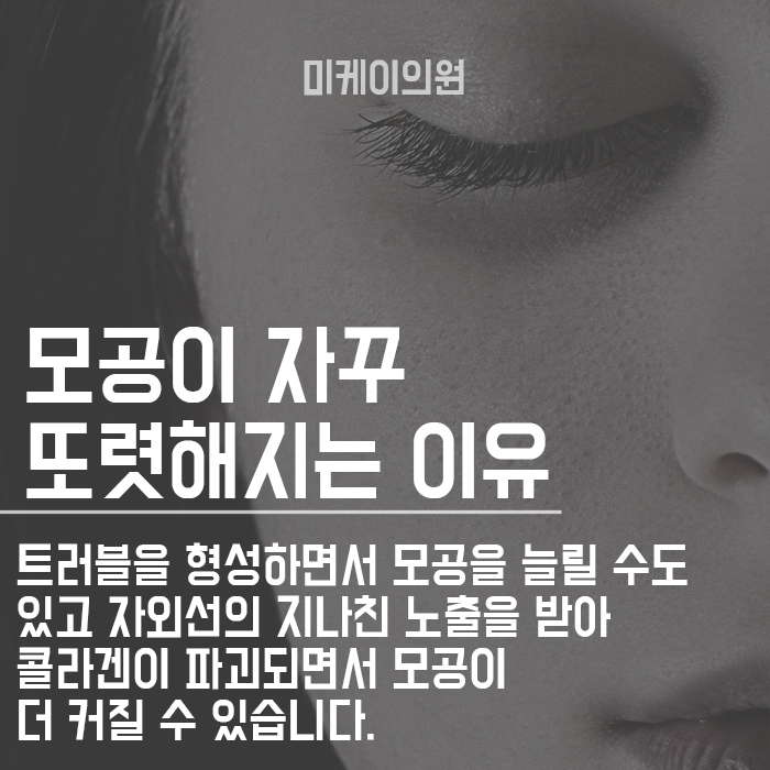 모공 넓어지는 이유 혼자서도 케어할 수 있다 관련 이미지 2