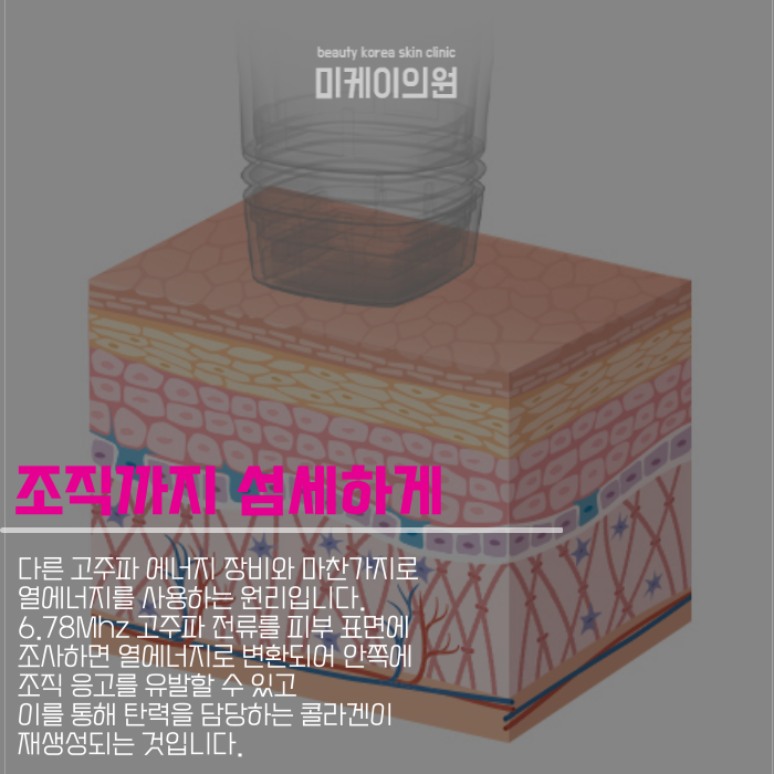 강남 볼뉴머 겨울에 더 필요한 이유 관련 이미지 3