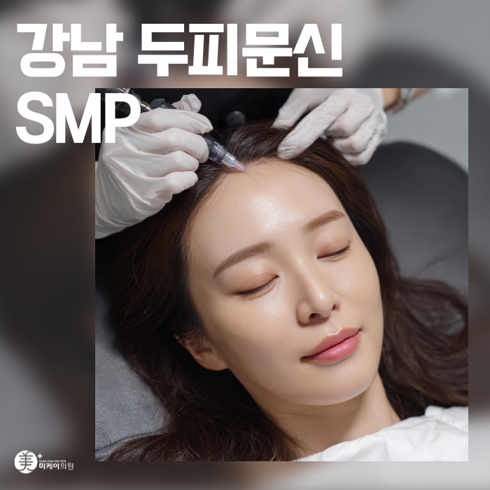 강남 두피문신 SMP 정수리와 이마 고민 관련 이미지 1