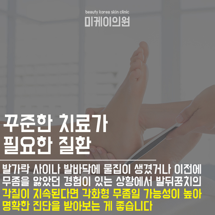 발뒤꿈치관리법 홈케어가 어렵다면 관련 이미지 4