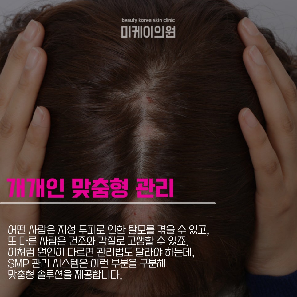 Starting Scalp Care with Scalp SMP at Gangnam Station image 4