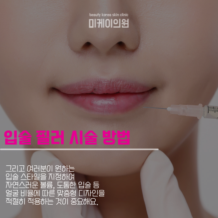 강남역 입술필러 매력적인 인상 만들기 관련 이미지 4