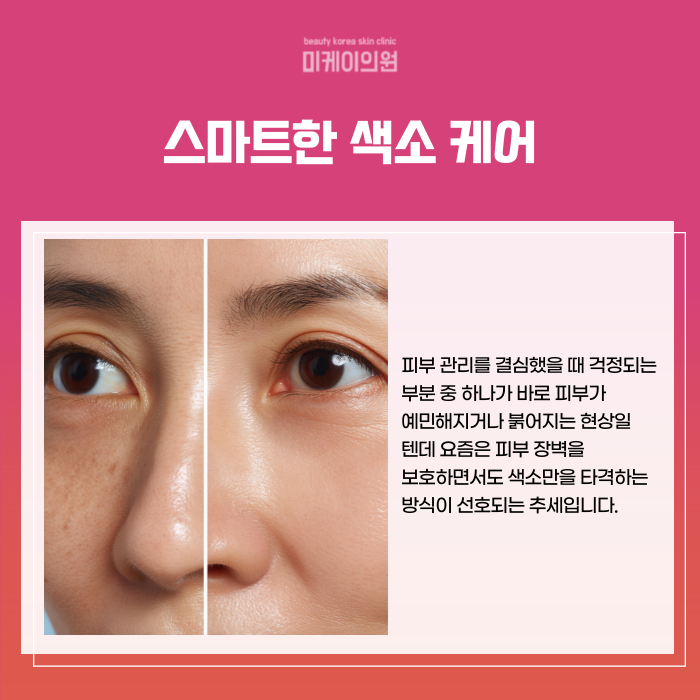 강남역 레이저토닝 기미 잡티 고민 관련 이미지 3