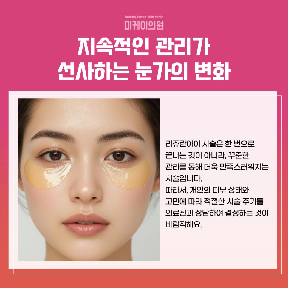 강남역 리쥬란아이 효과로 눈가에 생기를 관련 이미지 5