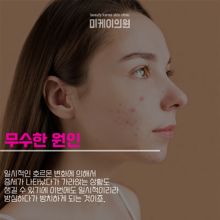 강남여드름피부과 마음의 짐을 덜려면 관련 이미지 2