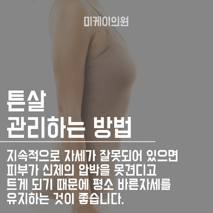튼살 집에서 관리하는 방법 알려드립니다 관련 이미지 2