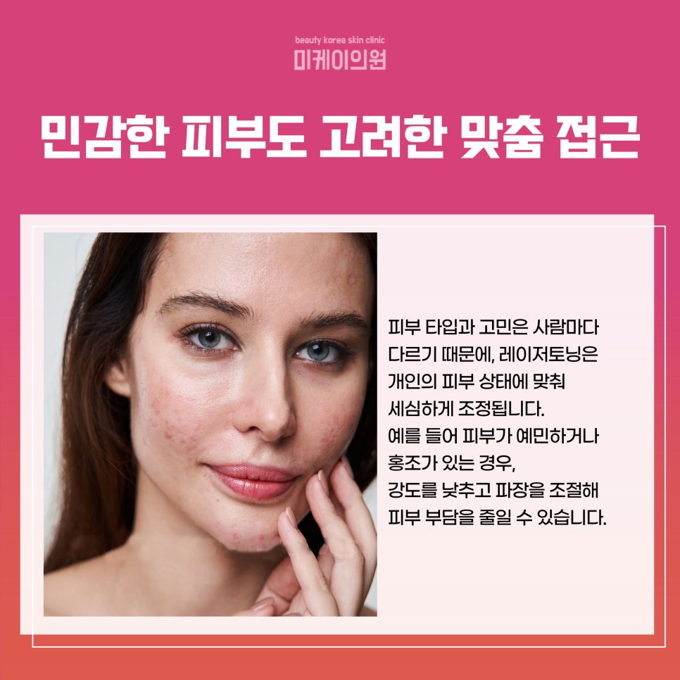 Gangnam Station Laser Toning Awaken the Light Within Your Skin image 3