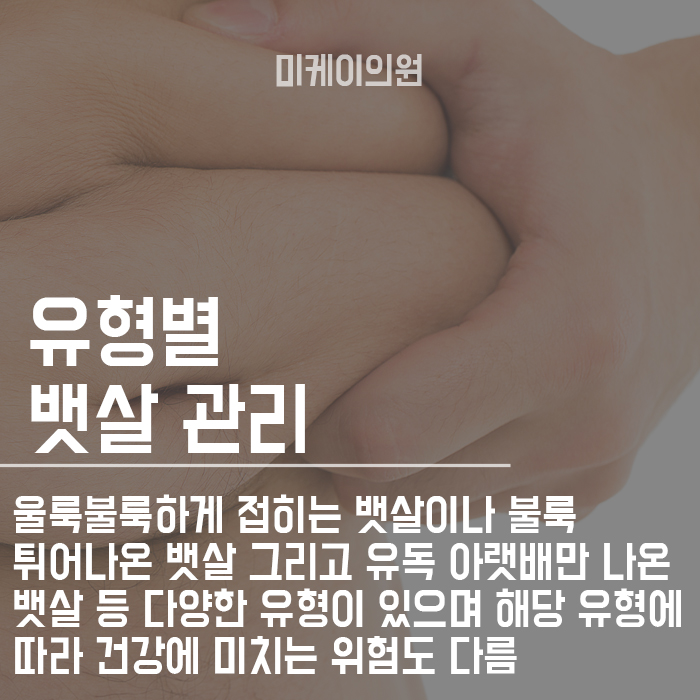 서초다이어트 효과적으로 복부지방분해 하기 관련 이미지 2