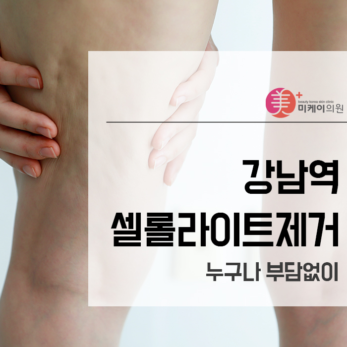 강남역셀롤라이트제거 누구나 부담없이 관련 이미지 1