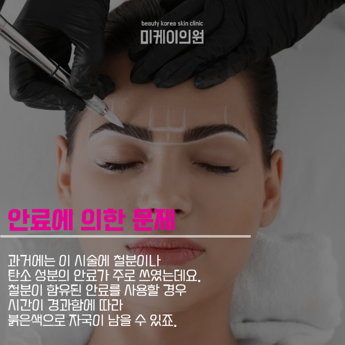 반영구잔흔커버 원인부터 시술 후 관리까지 관련 이미지 2