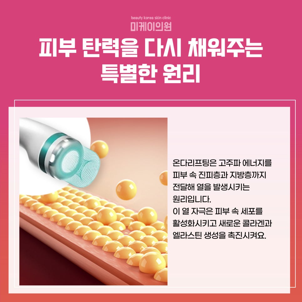 Gangnam Station Onda Lifting: 80,000 lines to lift even deep within the skin image 2