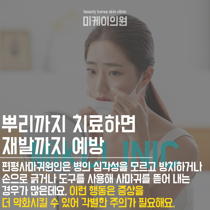 편평사마귀원인 개인에 따라 다를 수 있어 관련 이미지 5