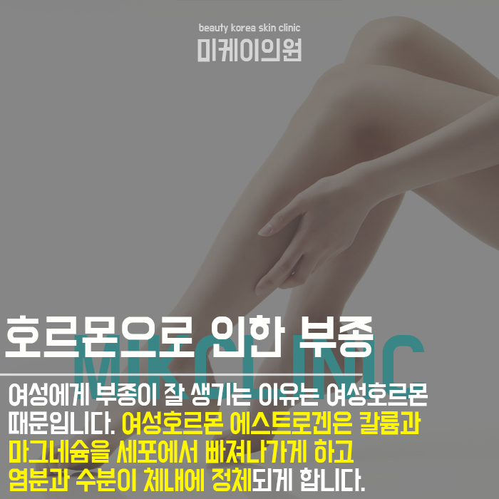 다리 붓기빼는 자세로 부종 정리할 수 있어요 관련 이미지 3